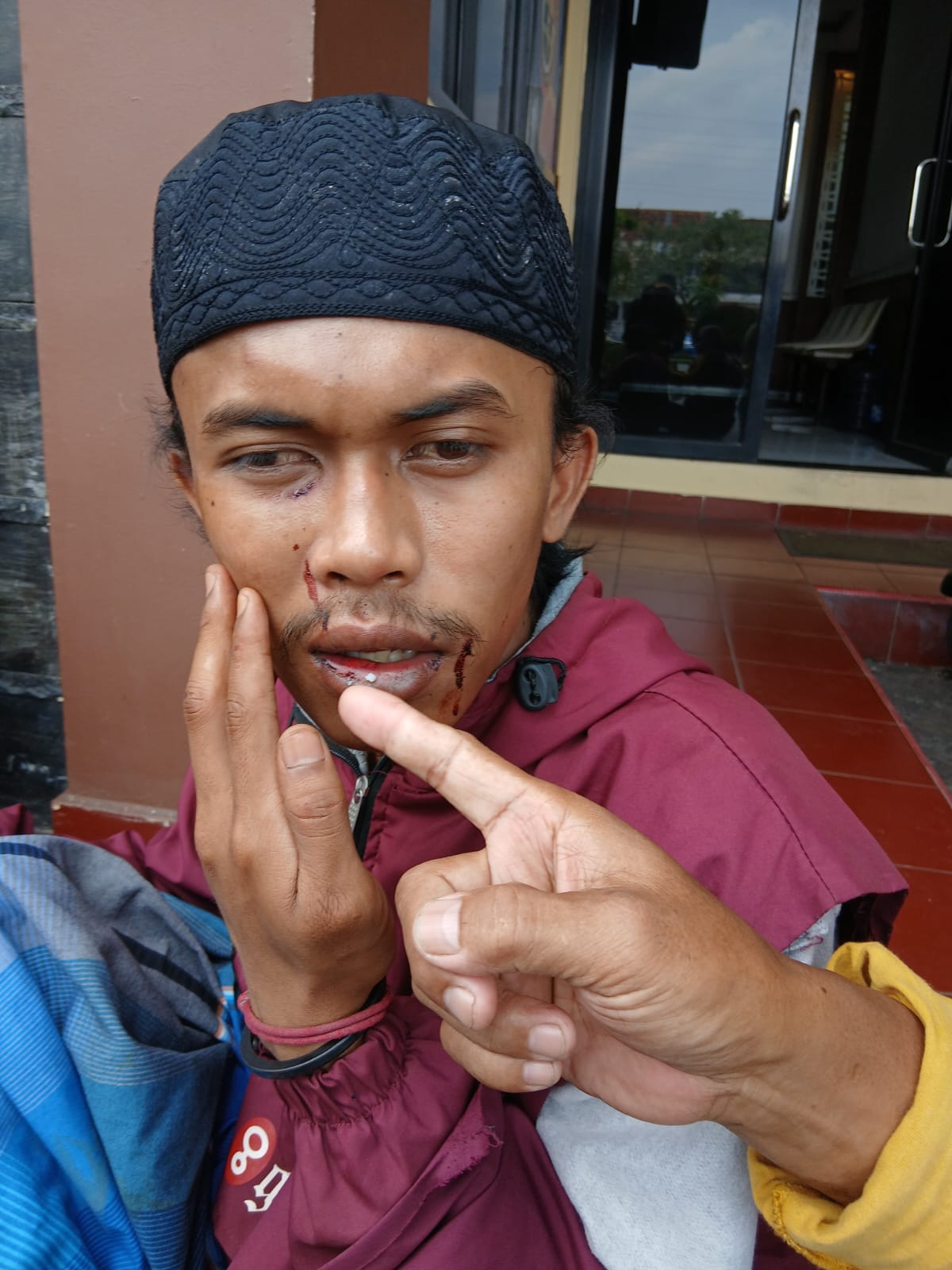 Coba Ingatkan Efek Miras, Santri di Tasikmalaya Dikeroyok 5 pemabuk